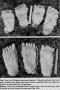 casts