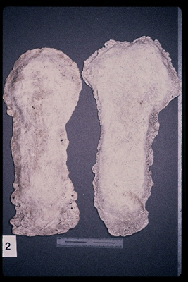 Kneeprints 1993, Washington/ Paul Freeman