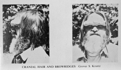 Cranial hair and browridges / Mankind Quarterly, 1973