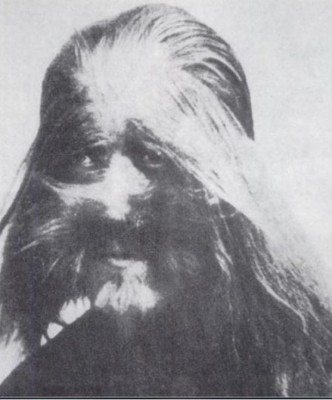 A photo of Li Baoshu who was born with the condition hypertrichosis, also known as “werewolf syndrome,” that causes excessive hair growth. The picture was on display at Beijing’s zoo in the 1920s. (Public domain)